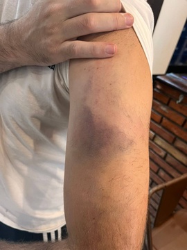 Poliziaren gehiegikeria eta gezurrez beteriko kontakizun mediatikoa salatu ditu Azpeitiko Gaztetxeak (3)