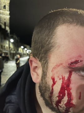 Gasteizen jasandako polizia-jazarpena eta alderdi politikoen isiltasuna salatu ditu GKSk (1)