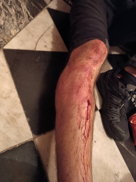 Gasteizen jasandako polizia-jazarpena eta alderdi politikoen isiltasuna salatu ditu GKSk (3)