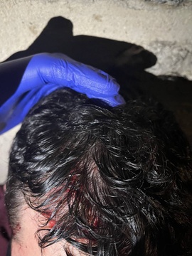 Gasteizen jasandako polizia-jazarpena eta alderdi politikoen isiltasuna salatu ditu GKSk (5)
