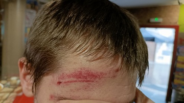 Gasteizen jasandako polizia-jazarpena eta alderdi politikoen isiltasuna salatu ditu GKSk (6)
