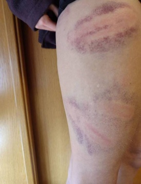 Gasteizen jasandako polizia-jazarpena eta alderdi politikoen isiltasuna salatu ditu GKSk (12)