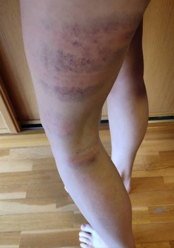 Gasteizen jasandako polizia-jazarpena eta alderdi politikoen isiltasuna salatu ditu GKSk (13)