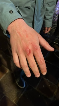 Gasteizen jasandako polizia-jazarpena eta alderdi politikoen isiltasuna salatu ditu GKSk (15)