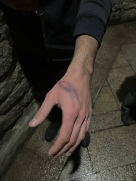 Gasteizen jasandako polizia-jazarpena eta alderdi politikoen isiltasuna salatu ditu GKSk (16)
