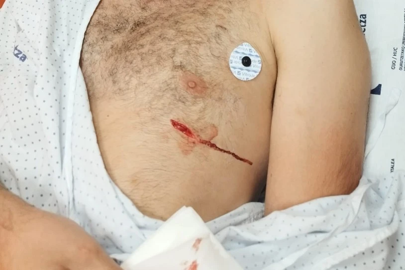 Barakaldon, militante politiko bati eraso dio faxista talde batek
