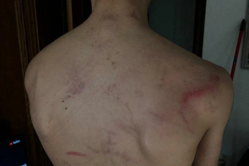 Polizia indarkeria salatu du Gasteizko udaltzainei arrautzak botatzeagatik atxilotua izan zen gazteak