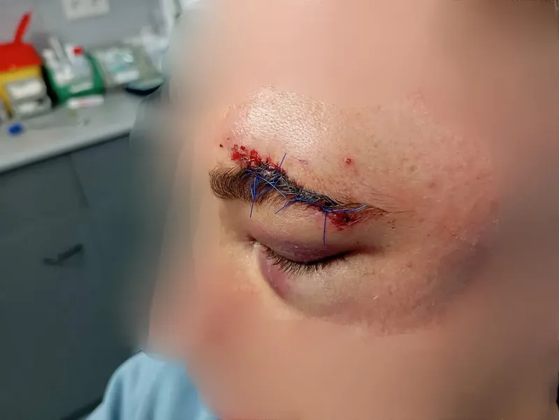 Sadarren Poliziak zauritutako pertsonen irudiak argitaratu dituzte