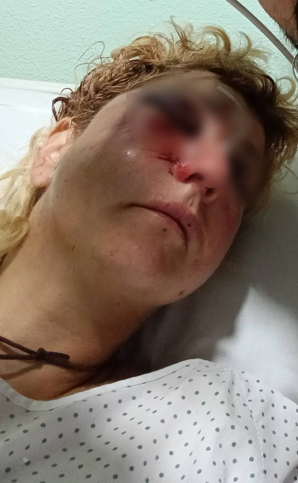 Ertzaintzak bultzatutako eraso bat salatu du Errekaleorrek