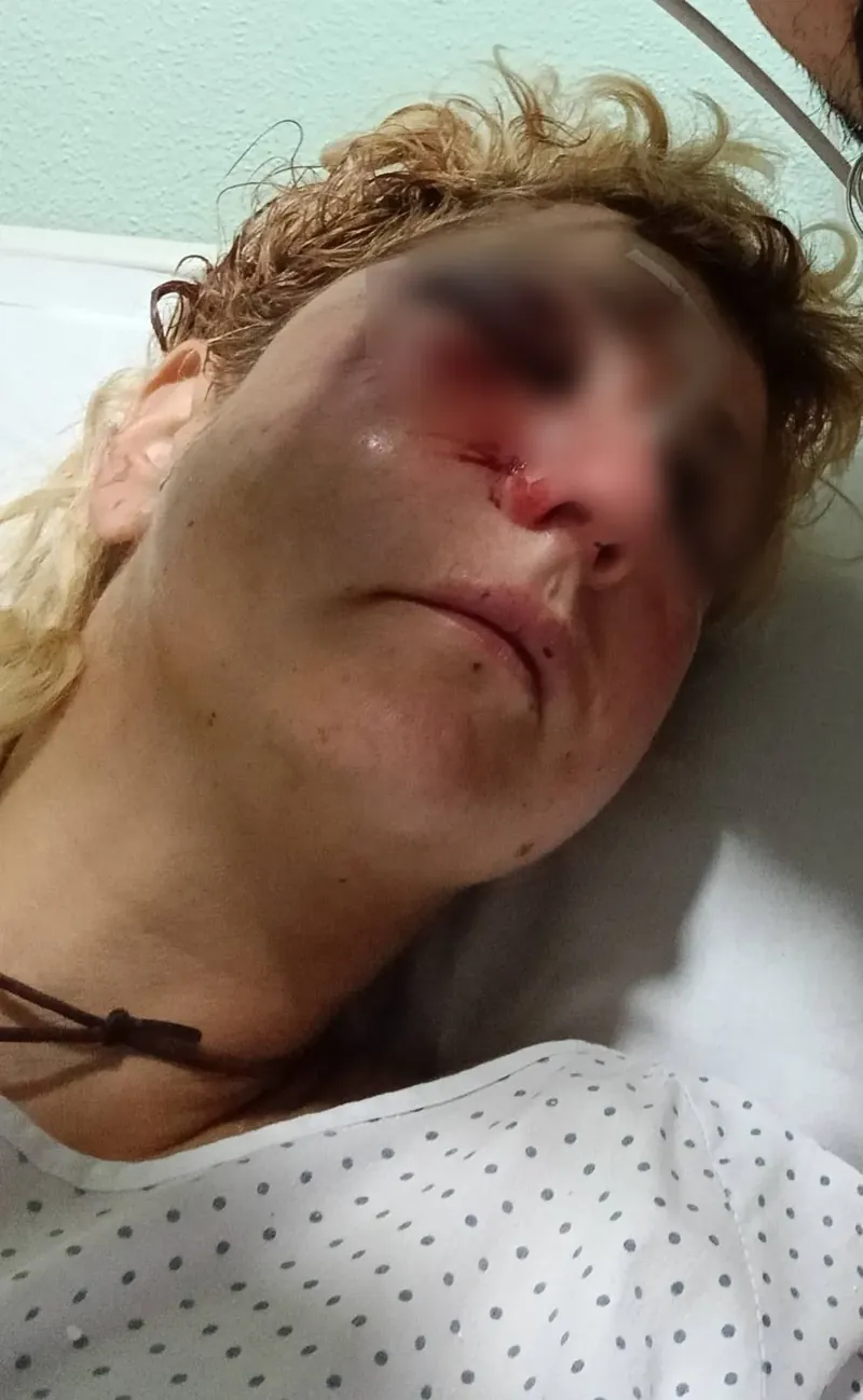 Ertzaintzak bultzatutako eraso bat salatu du Errekaleorrek