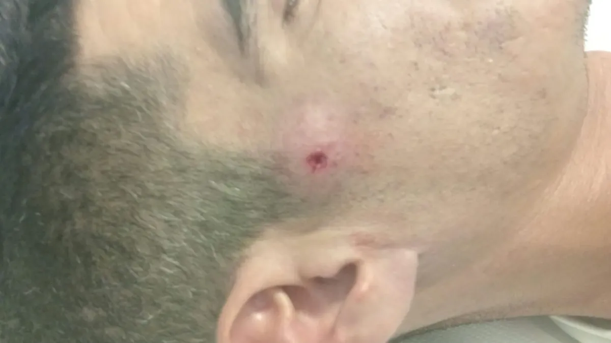 Donostiako azken eraso arrazista salatzeko, protesta bat izango da gaur arratsaldean
